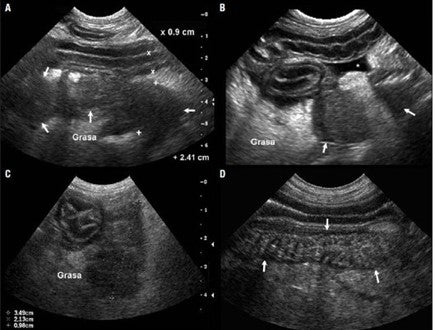 Pancreatitis en perros y gatos