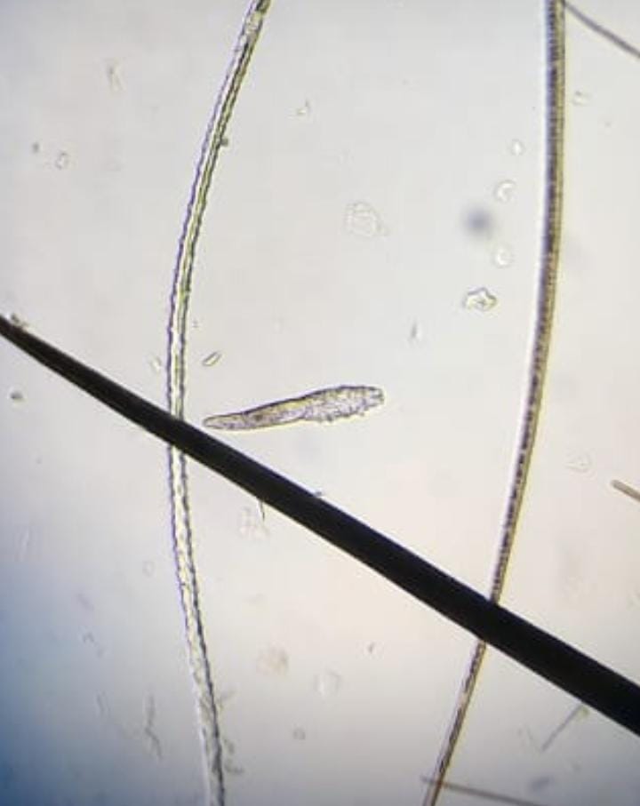 Demodex 